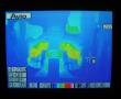 Thermographie